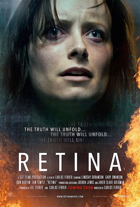 Retina-watch