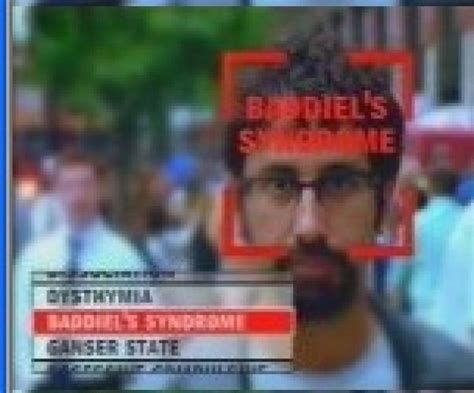 Baddiel's Syndrome Baddiel's Syndrome-watch