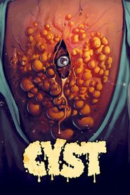 Cyst 